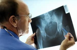 An orthopedic surgeon looking at an x-ray of a hip